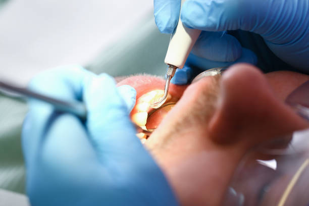 Best Dentist for Dental Trauma  in East Grand Forks, MN