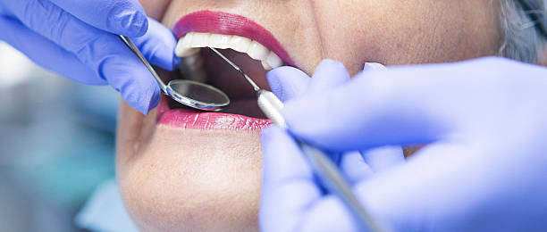 Best Chipped Tooth Repair Near Me  in East Grand Forks, MN
